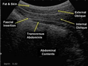 real time ultrasound muscle image gold coast